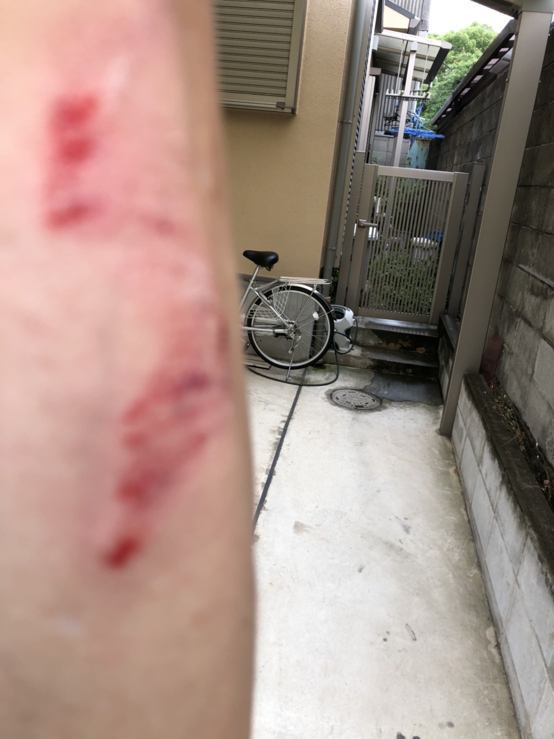 雨が降っていて入口の鉄板で滑って、塀の壁でこすってしまいました。 いたーーーーー